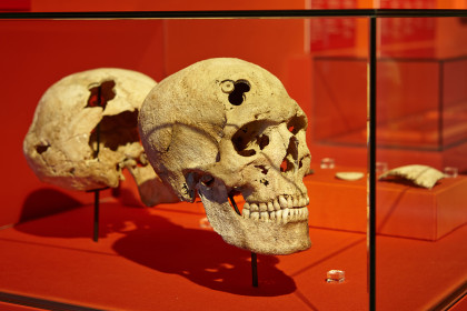 In den Knochen gespeichert - Krankheitsgeschichten aus der La Tène Zeit